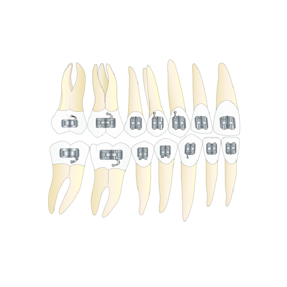 DDS - Teeth and Arches with Straight Wire Attachments - College